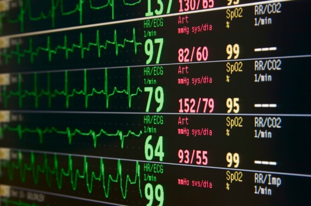 An ECG Monitor screen.